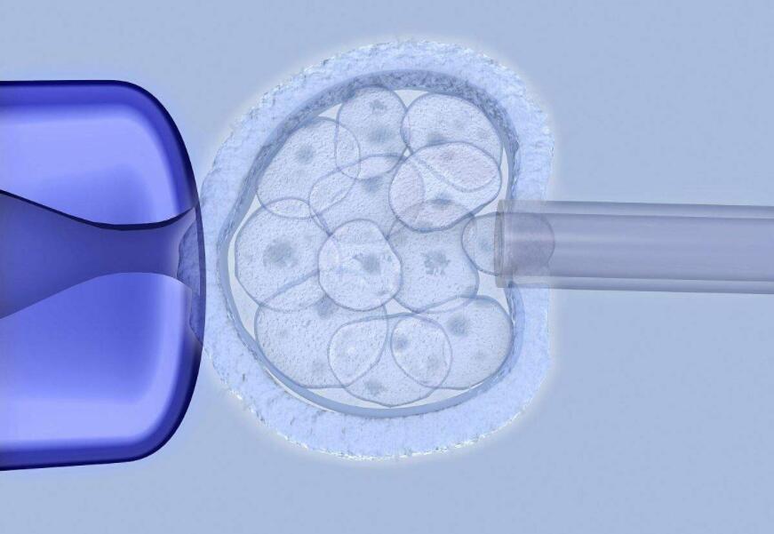 什么是胚胎植入前遗传学诊断？